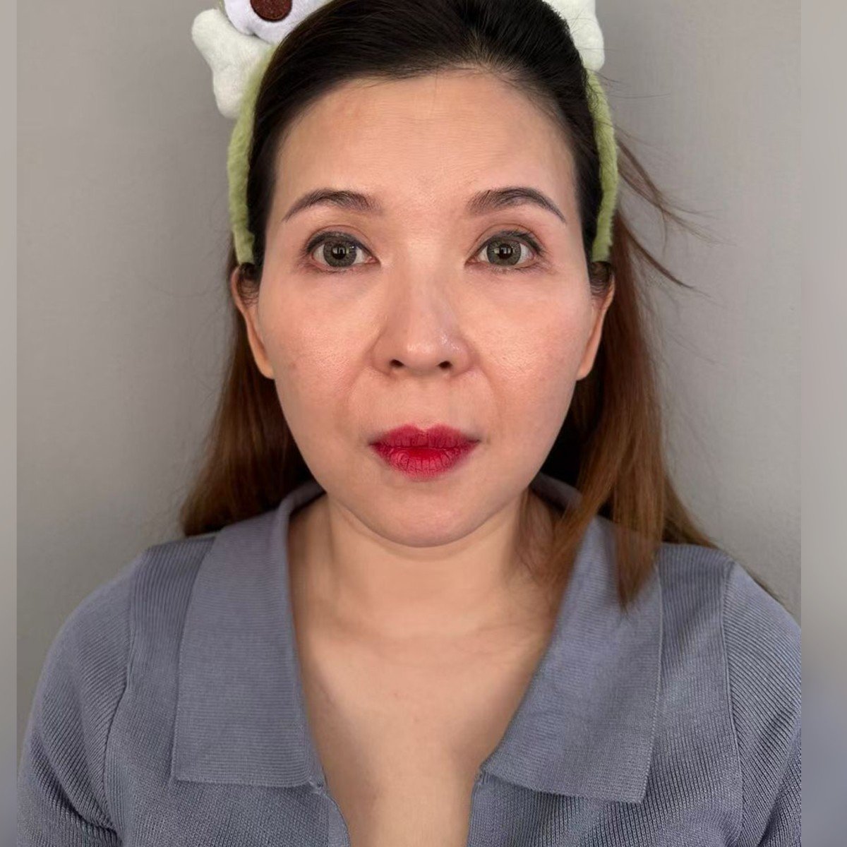 KHAW SIEW IMM · Before