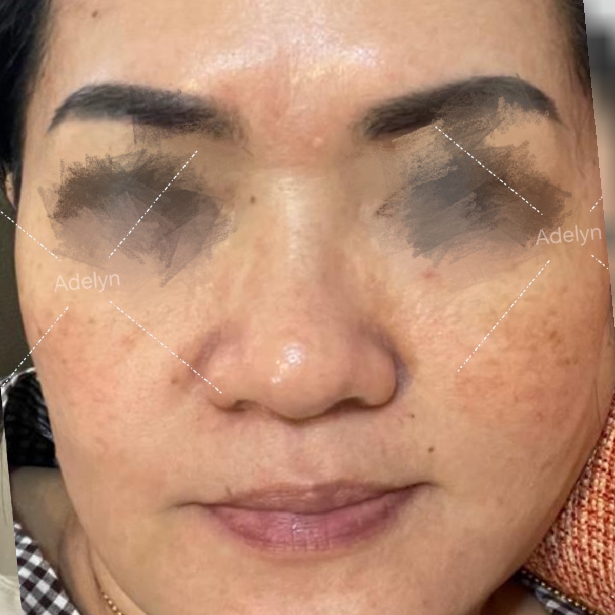 Selepas: Repair skin barrier