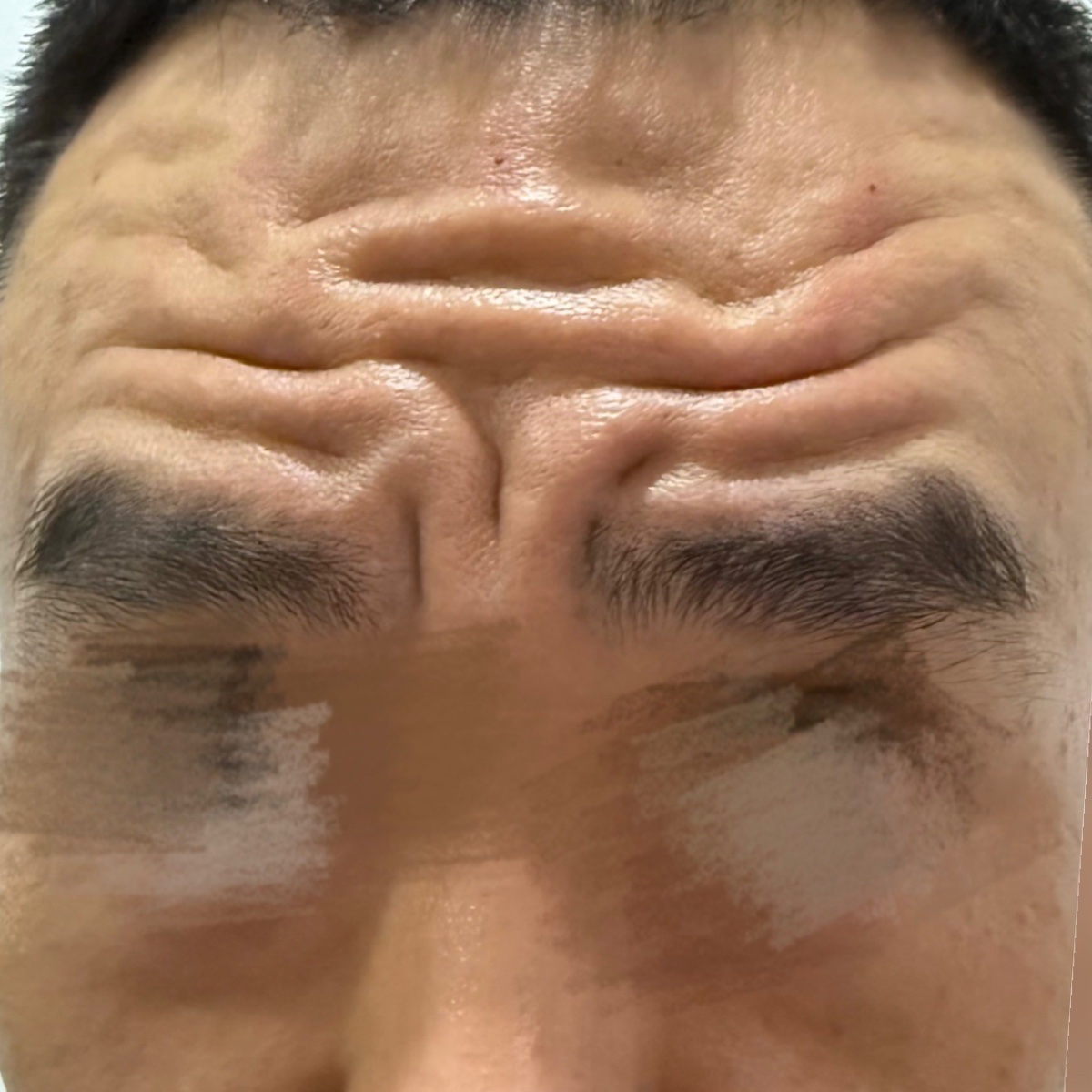 Before: Wrinkle Removal 祛皱