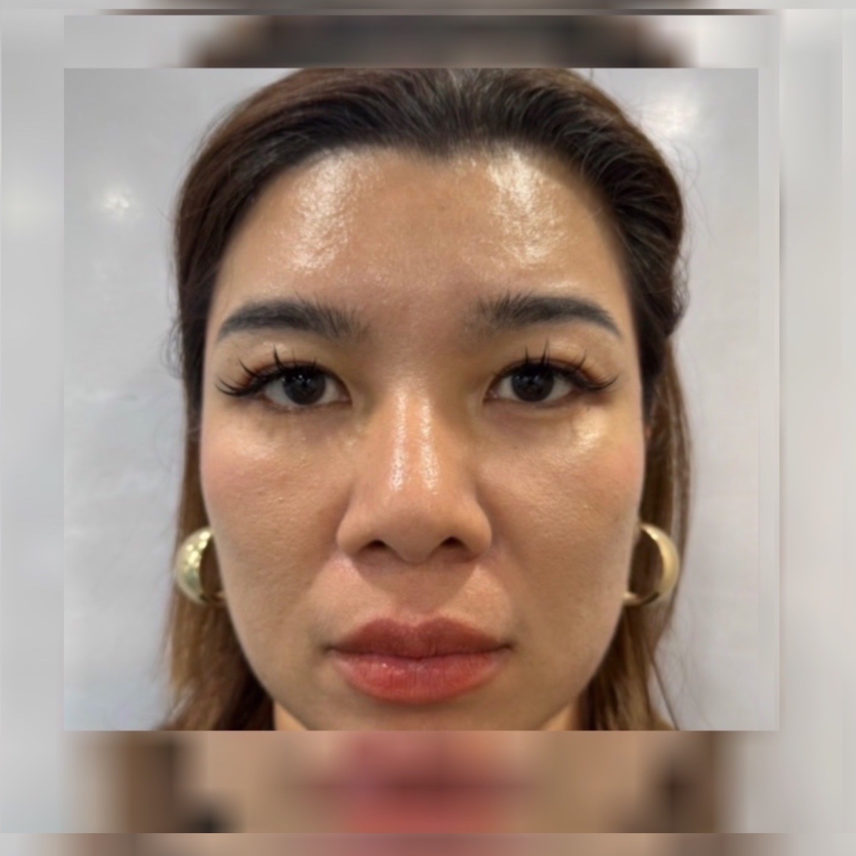Selepas: 全脸打造