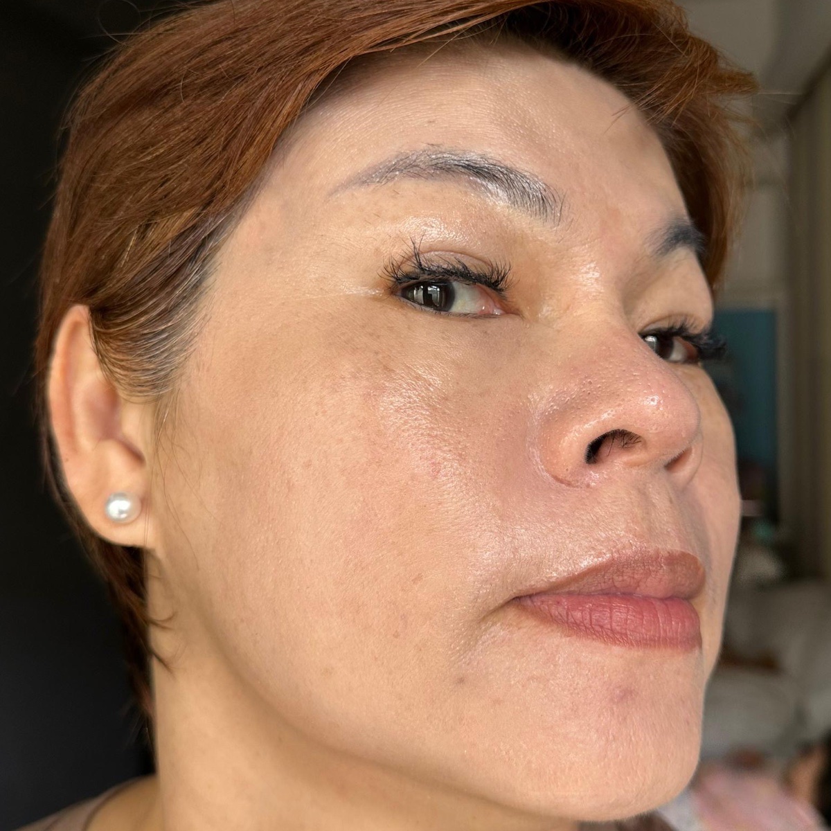 After: BRIGHTER SKIN