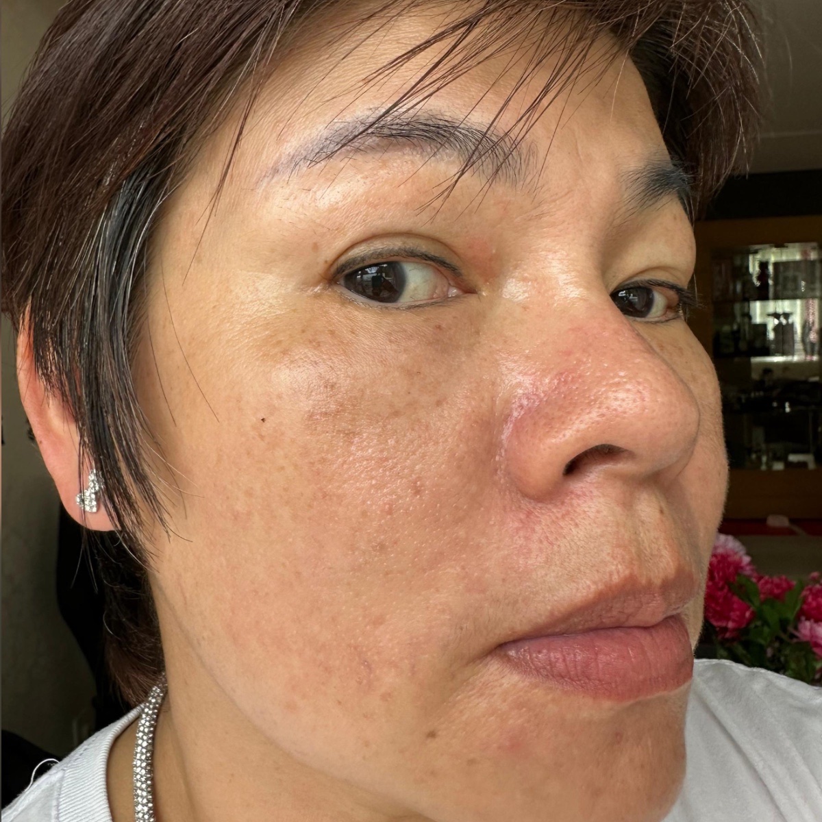 Before: BRIGHTER SKIN