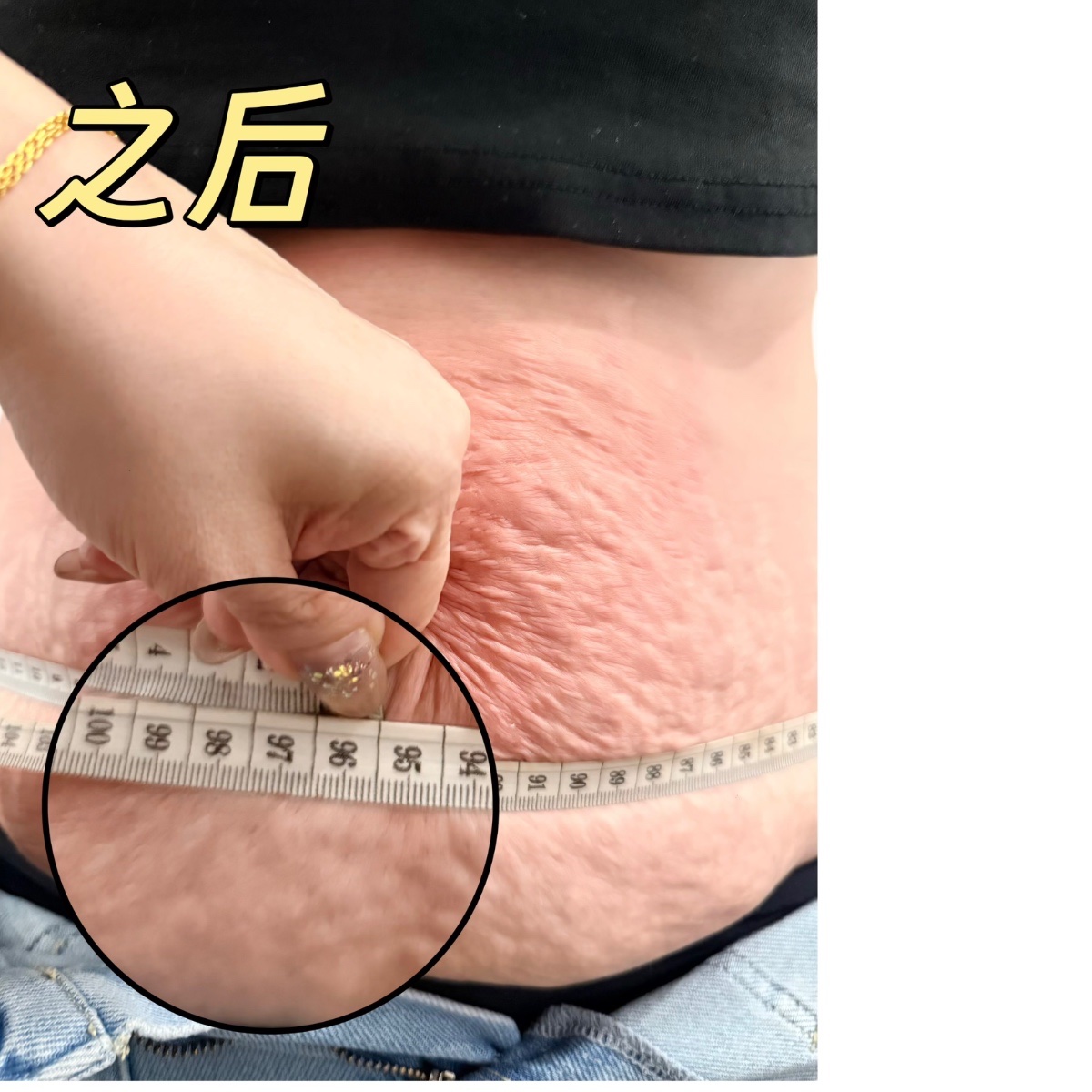 Selepas: 三胎宝妈、做一次躺瘦三宝之后