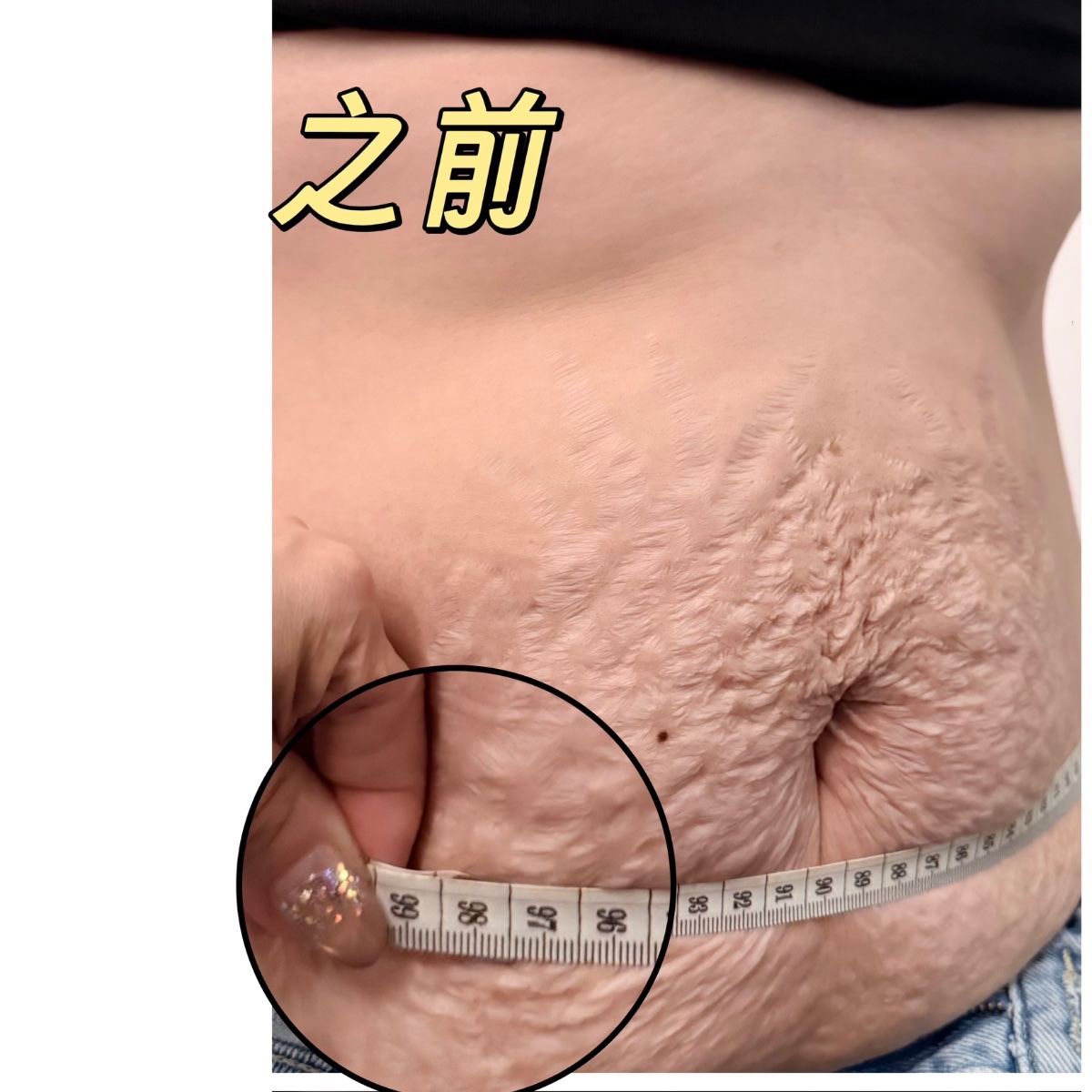Sebelum: 三胎宝妈、做一次躺瘦三宝之后