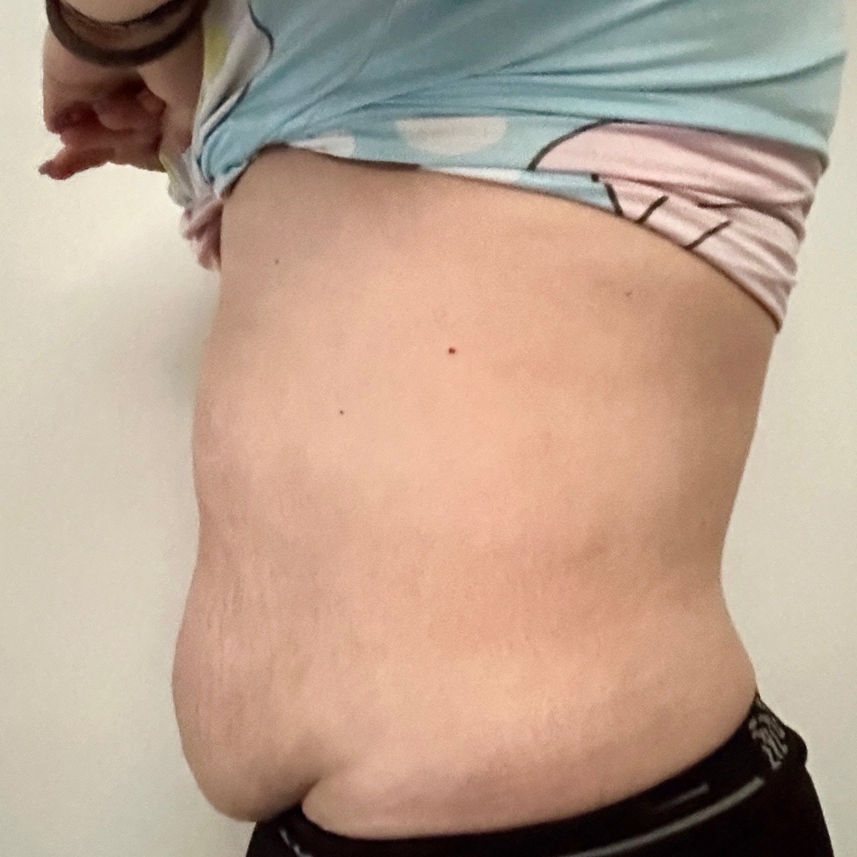 After: 一个月轻松瘦了4.5kg 不节食