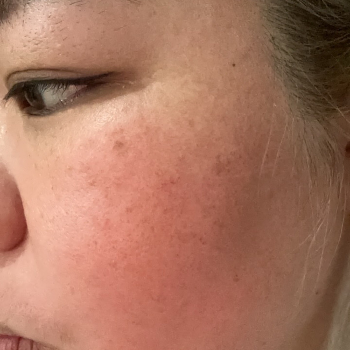 Before: 使用7日白的效果
