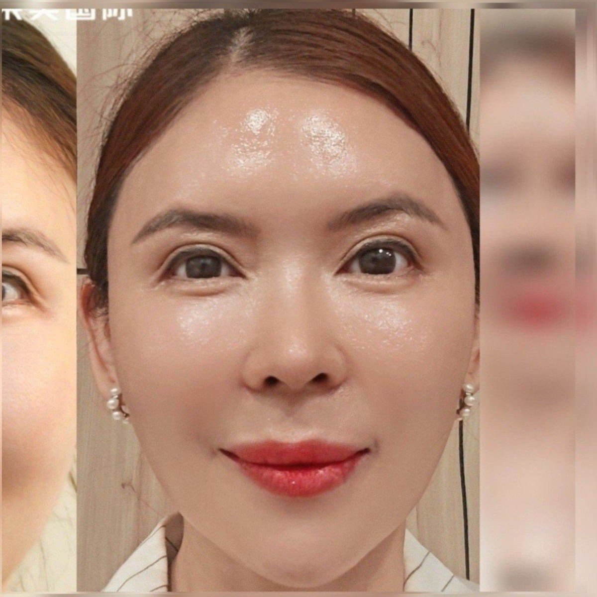 After: 全脸打造
