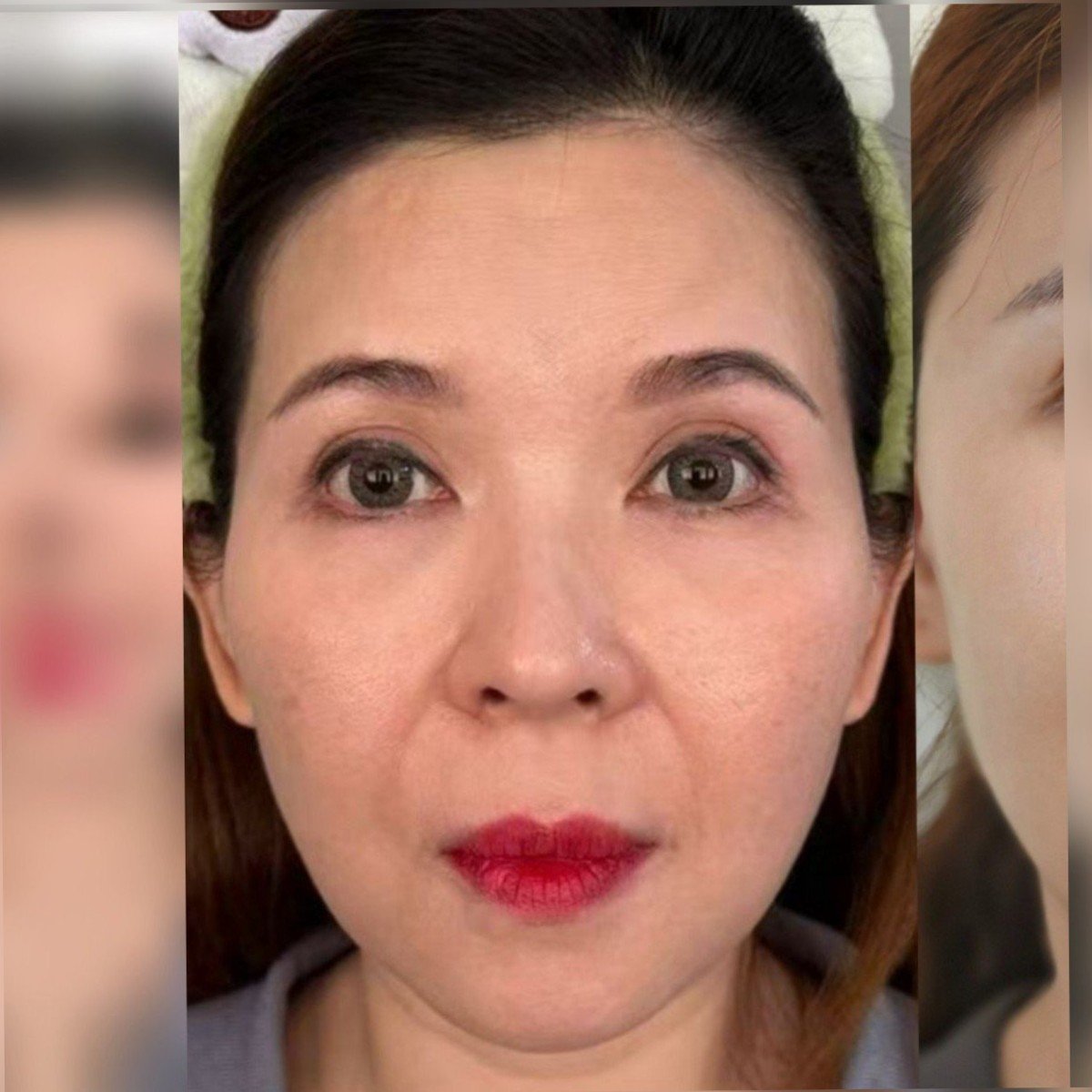 Before: 全脸打造