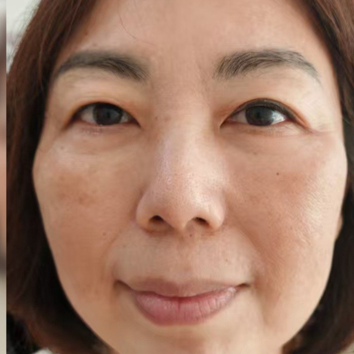 Sebelum: 一次的黄金炮和V脸紧致